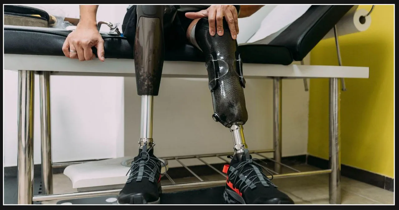 Health insurers place restrictions on coverage for prosthetic limbs, raising doubts about their medical necessity